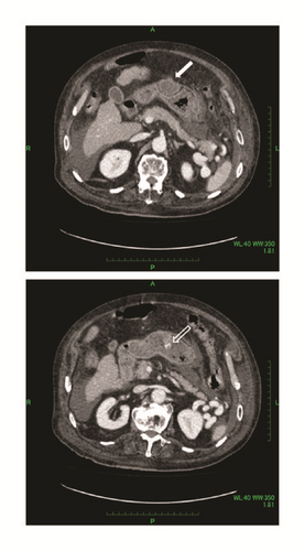 Details are in the caption following the image Details are in the caption following the image
