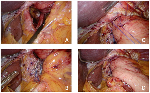 Details are in the caption following the image Details are in the caption following the image