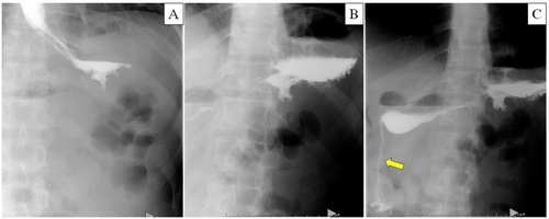 Details are in the caption following the image Details are in the caption following the image