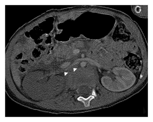 Details are in the caption following the image Details are in the caption following the image