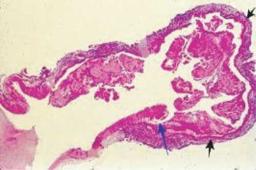 Details are in the caption following the image