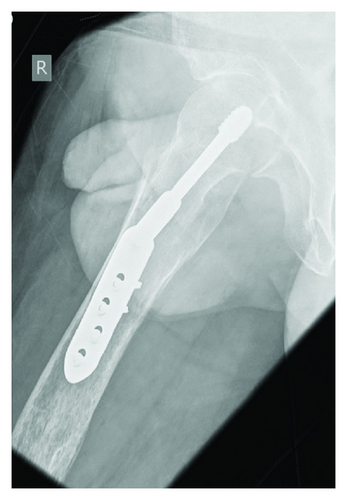 Details are in the caption following the image