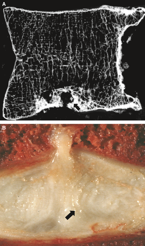 Details are in the caption following the image