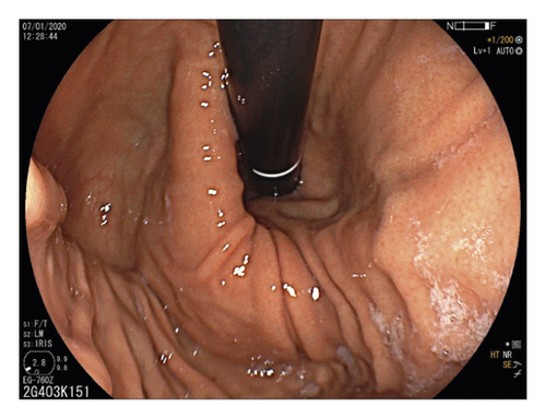Details are in the caption following the image Details are in the caption following the image