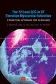 Cover image of The 12‐Lead ECG in ST Elevation Myocardial Infarction