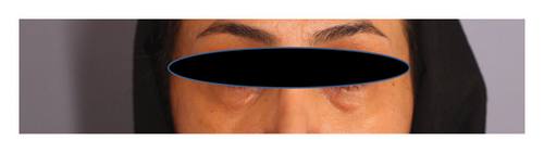 Details are in the caption following the image
