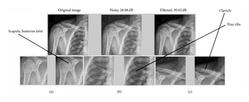 Details are in the caption following the image