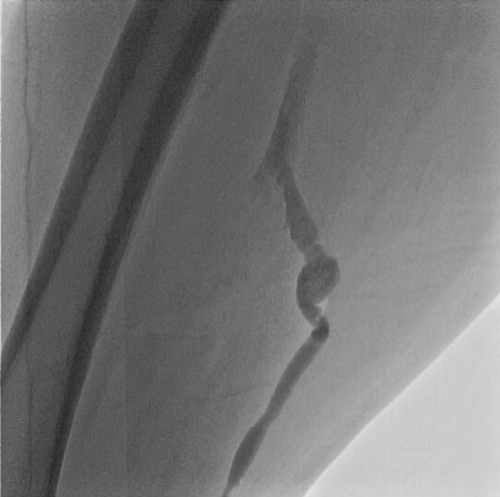 Details are in the caption following the image