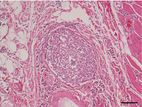 Retrospective analysis of cutaneous lesions in 23 canine and 17 feline cases of coccidioidomycosis seen in Arizona, USA (2009–2015)