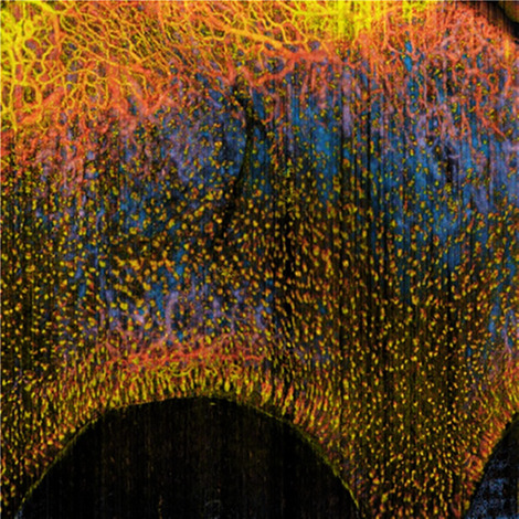 A noninvasive imaging and measurement using optical coherence tomography angiography for the assessment of gingiva: An in vivo study