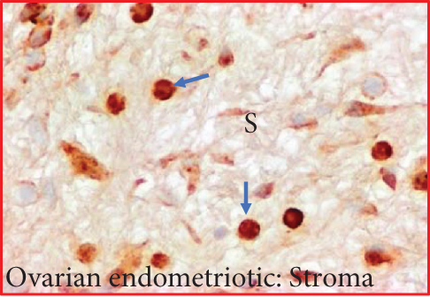 Details are in the caption following the image