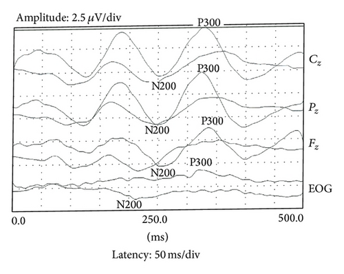 Details are in the caption following the image