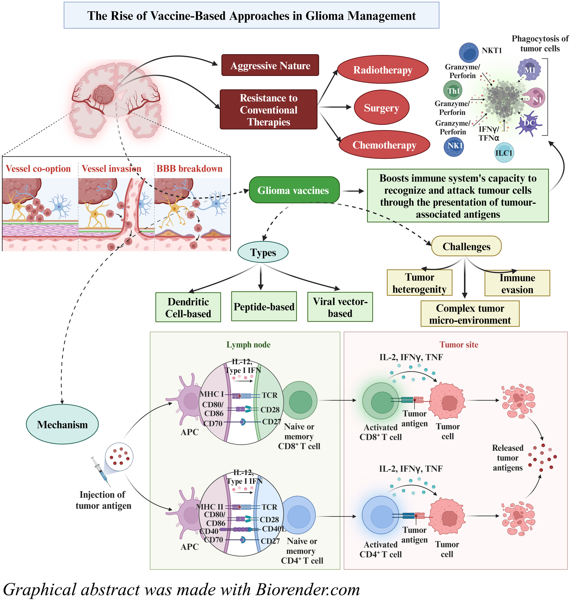 Immunotherapeutic advances in glioma management: The rise of vaccine-based approaches