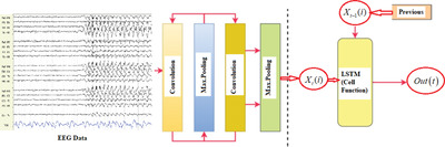 Sex differences in rTMS treatment response: A deep learning-based EEG investigation