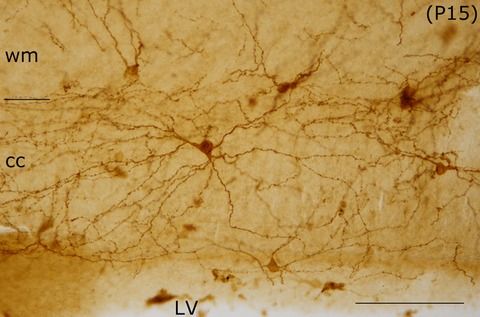 Substance P NK1 receptor in the rat corpus callosum during postnatal development