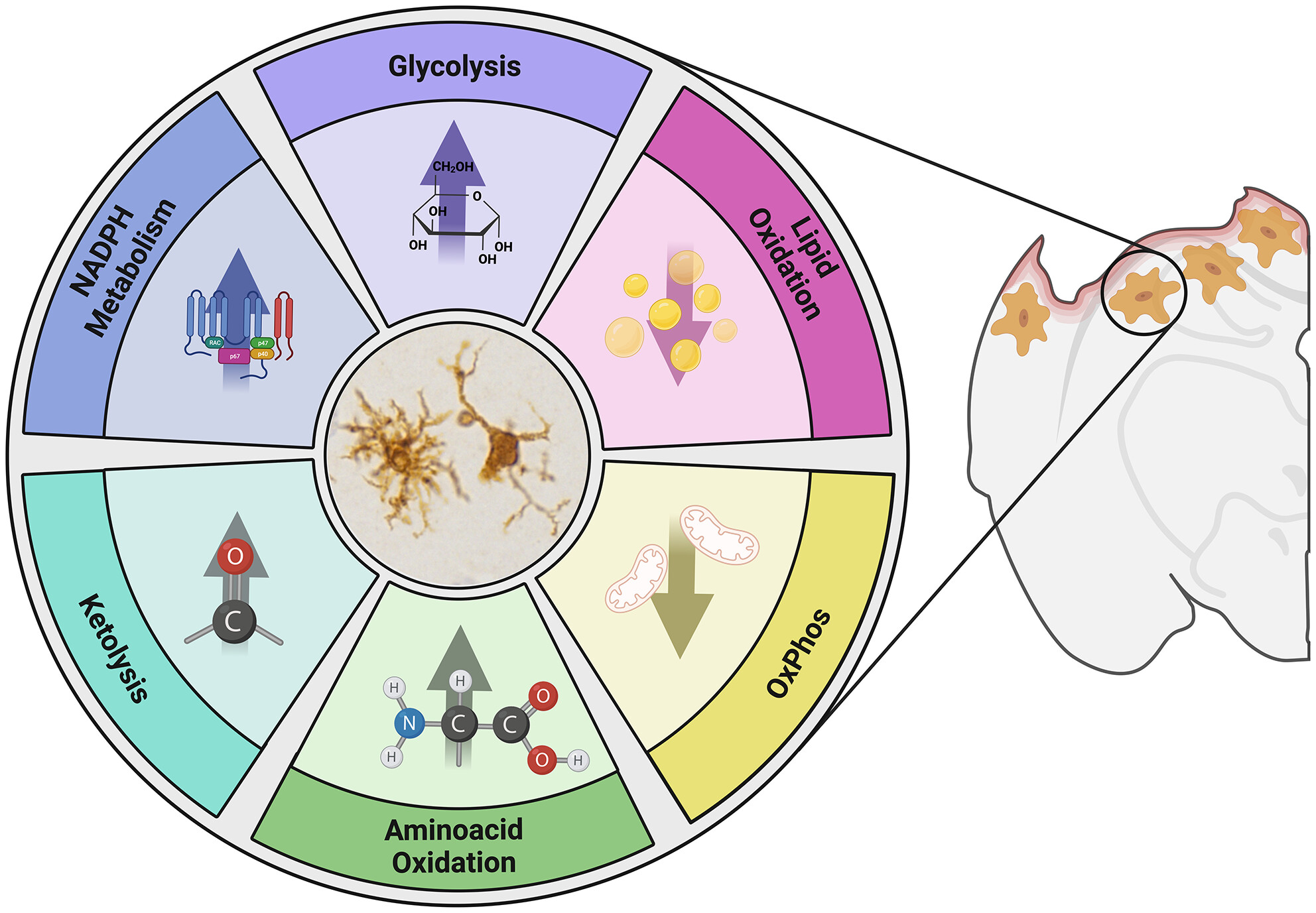 Fundamental Neurochemistry Review: Microglial immunometabolism in traumatic brain injury