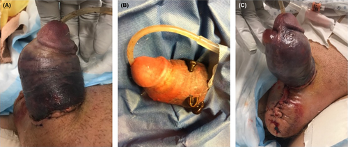 Details are in the caption following the image Details are in the caption following the image