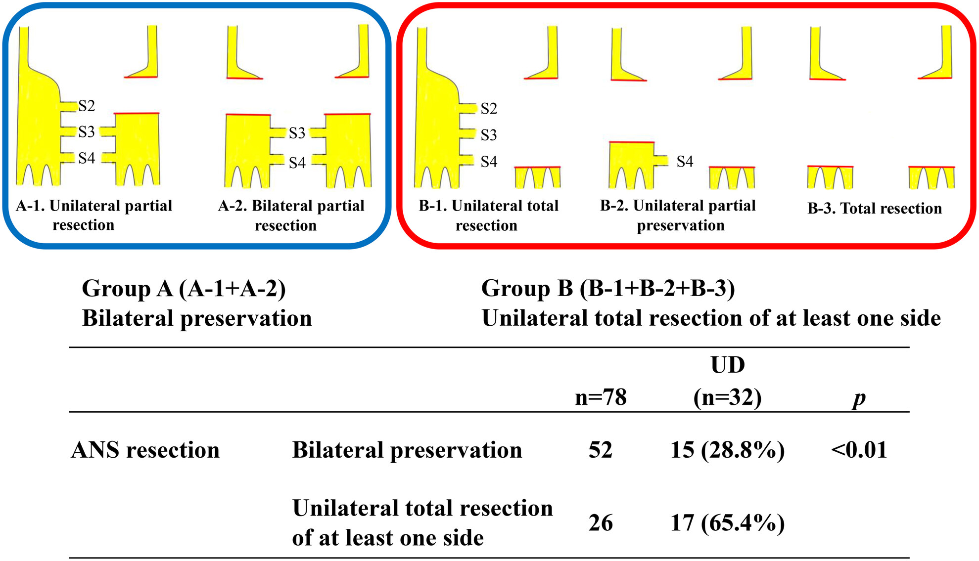 Effect of autonomic nervous system resection extent on urinary dysfunction in robotic rectal cancer surgery