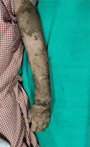 Details are in the caption following the image