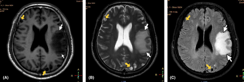Details are in the caption following the image Details are in the caption following the image