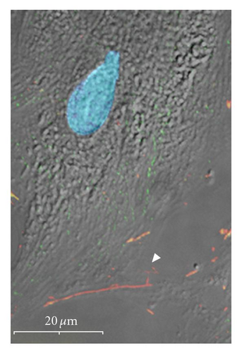Details are in the caption following the image