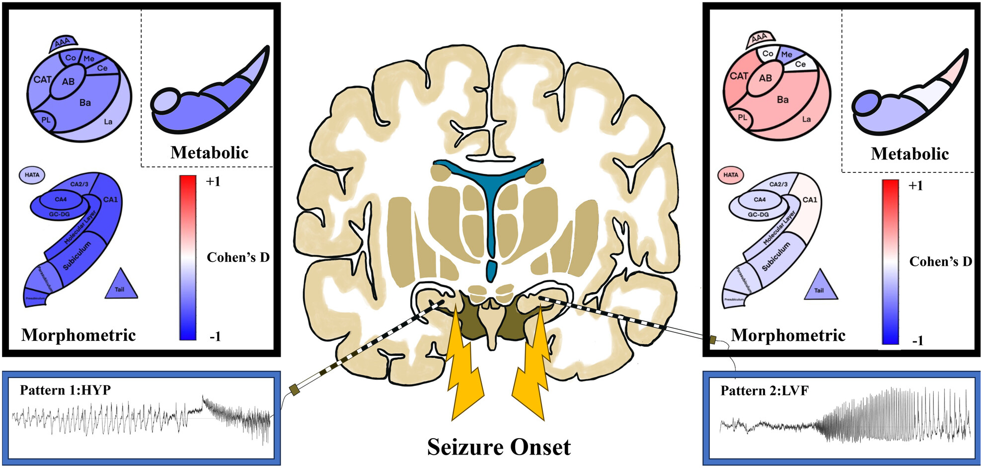 Delineating structural and metabolic abnormalities in amygdala and hippocampal subfields for different seizure-onset patterns via stereotactic electroencephalography