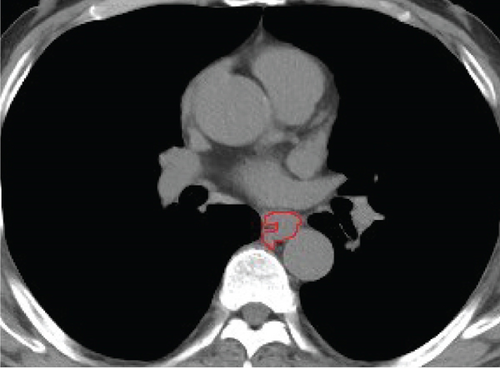 Details are in the caption following the image Details are in the caption following the image