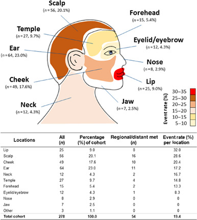 Gene expression profiling for metastatic risk in head and neck cutaneous squamous cell carcinoma