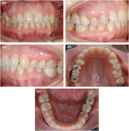Details are in the caption following the image Details are in the caption following the image