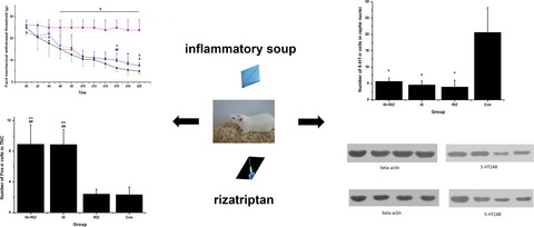 Rizatriptan overuse promotes hyperalgesia induced by dural inflammatory stimulation in rats by modulation of the serotonin system