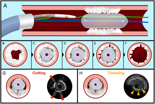 Details are in the caption following the image Details are in the caption following the image