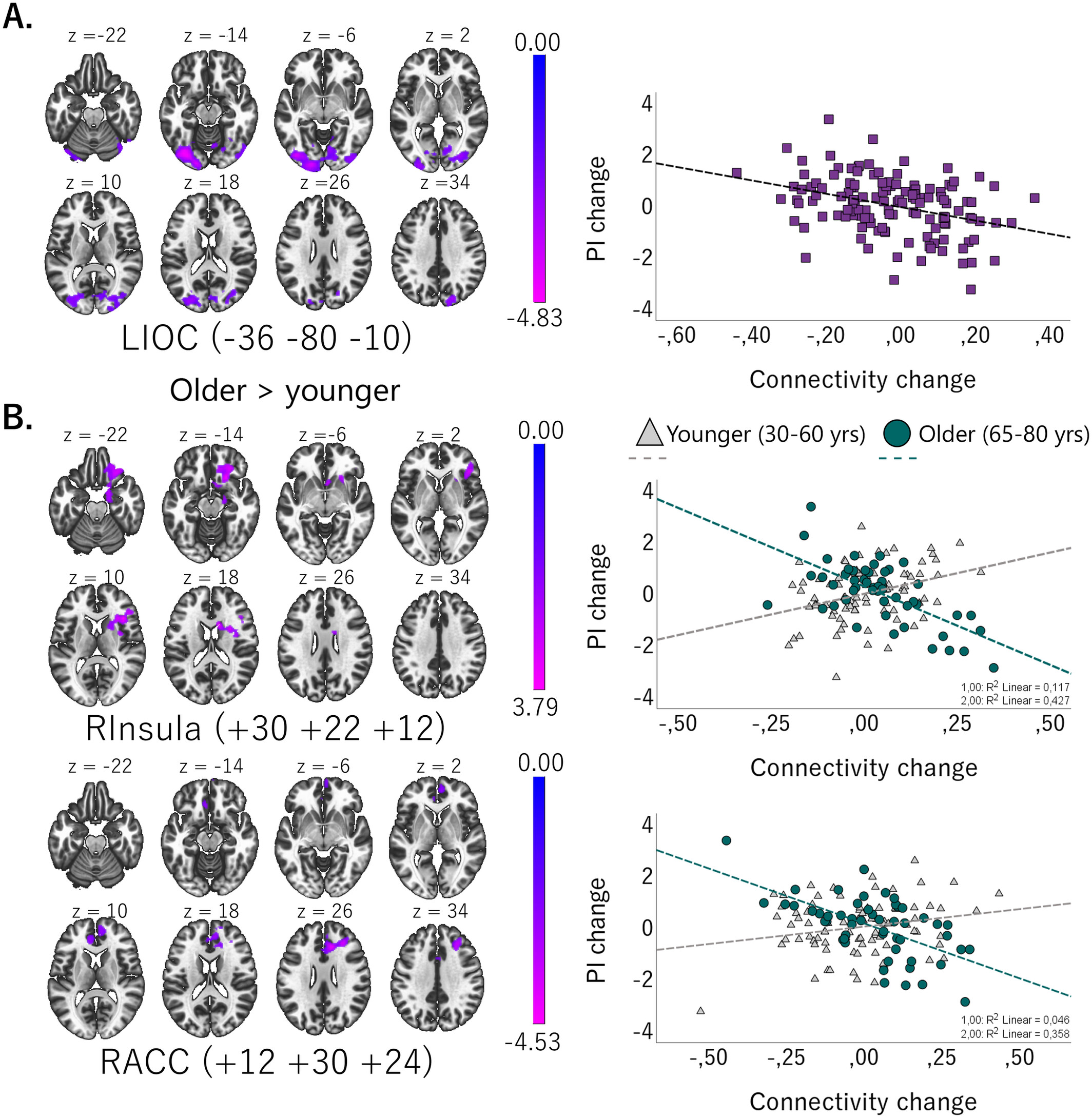 Age Differences in Brain Functional Connectivity Underlying Proactive Interference in Working Memory