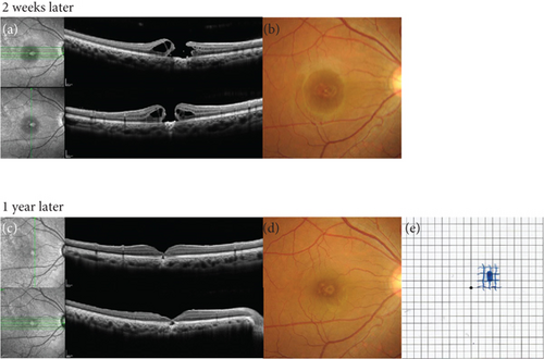 Details are in the caption following the image Details are in the caption following the image