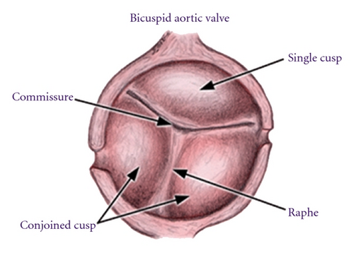 Details are in the caption following the image