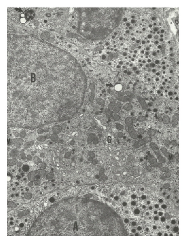 Details are in the caption following the image