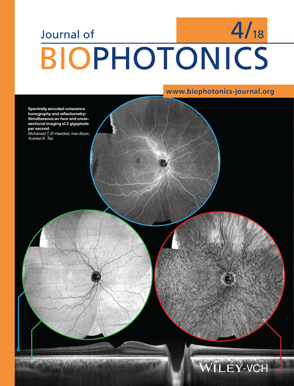 Front Cover: Spectrally encoded coherence tomography and reflectometry: Simultaneous en face and cross-sectional imaging at 2 gigapixels per second (J. Biophotonics 4/2018)