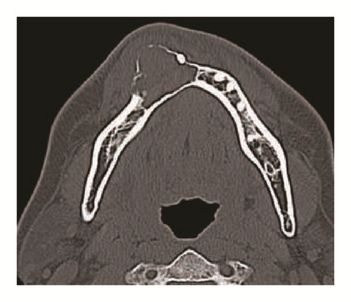 Details are in the caption following the image Details are in the caption following the image