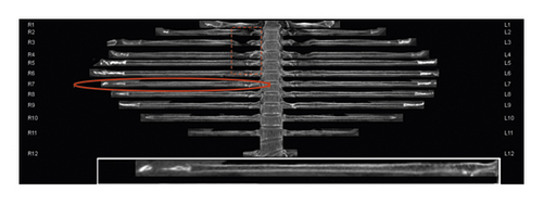 Details are in the caption following the image