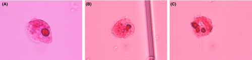 Details are in the caption following the image