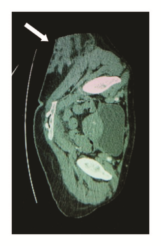 Details are in the caption following the image