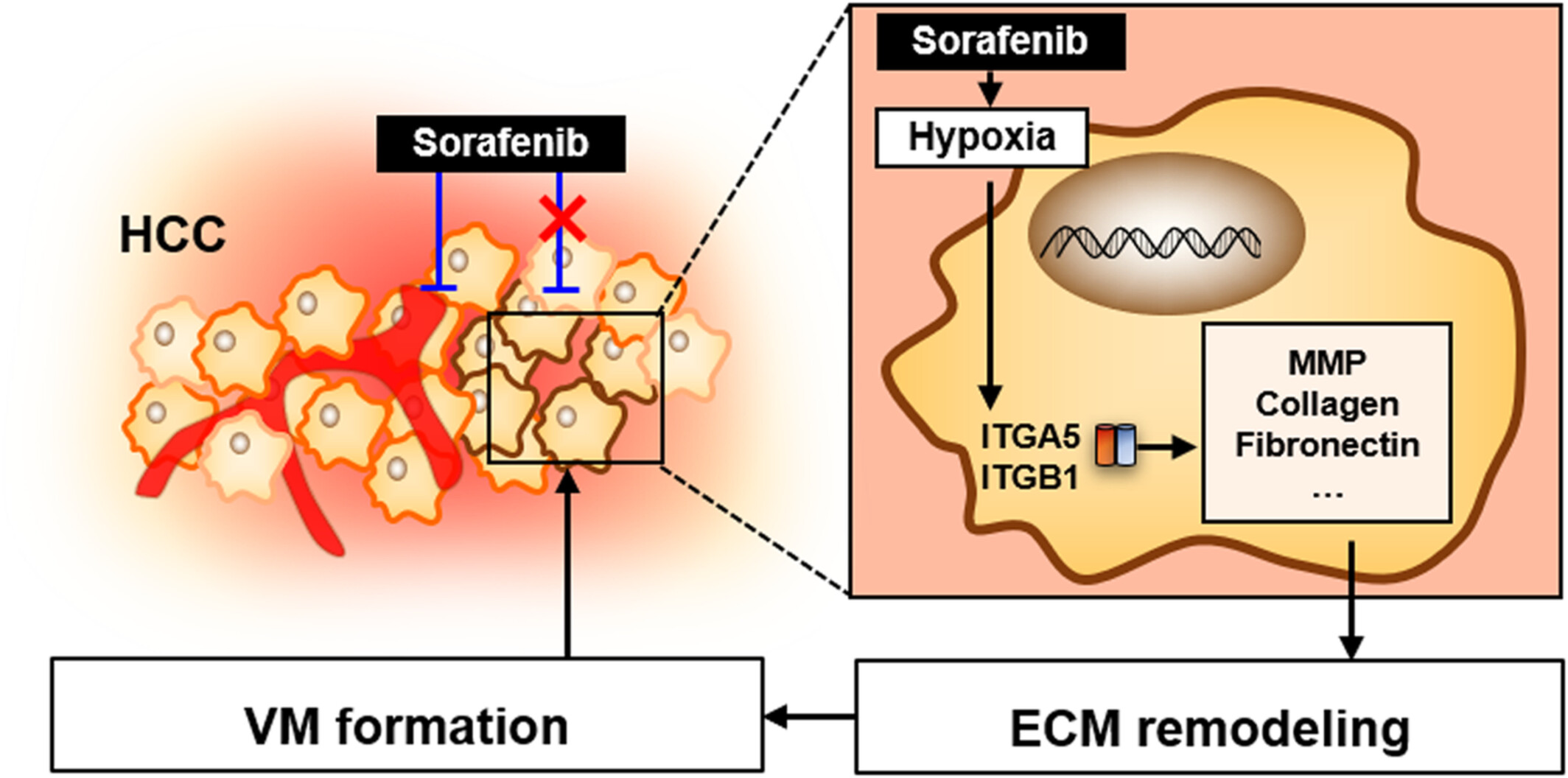 ITGA5 and ITGB1 contribute to Sorafenib resistance by promoting vasculogenic mimicry formation in hepatocellular carcinoma