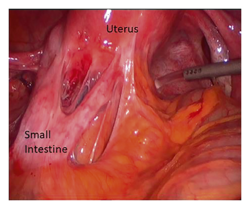 Details are in the caption following the image Details are in the caption following the image