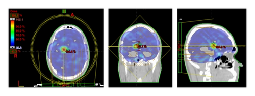 Details are in the caption following the image Details are in the caption following the image