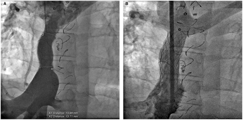 Details are in the caption following the image Details are in the caption following the image