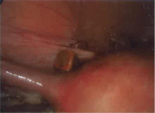 Details are in the caption following the image