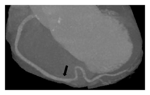 Details are in the caption following the image
