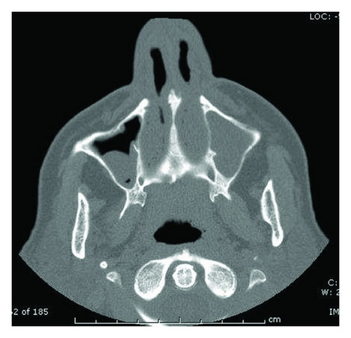 Details are in the caption following the image Details are in the caption following the image