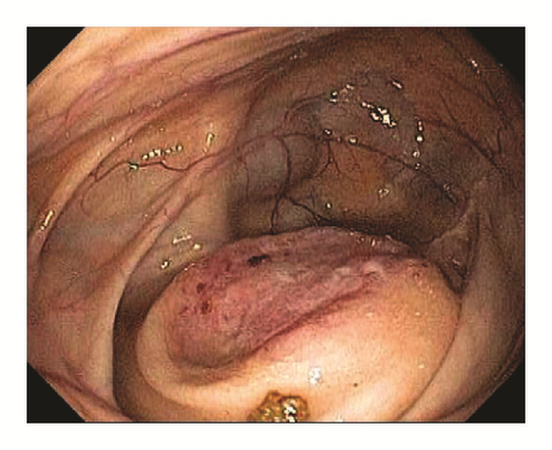Details are in the caption following the image Details are in the caption following the image