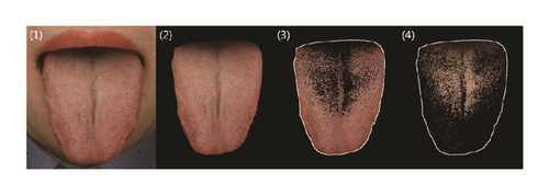 Details are in the caption following the image
