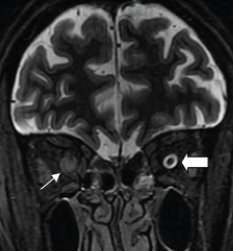 Details are in the caption following the image